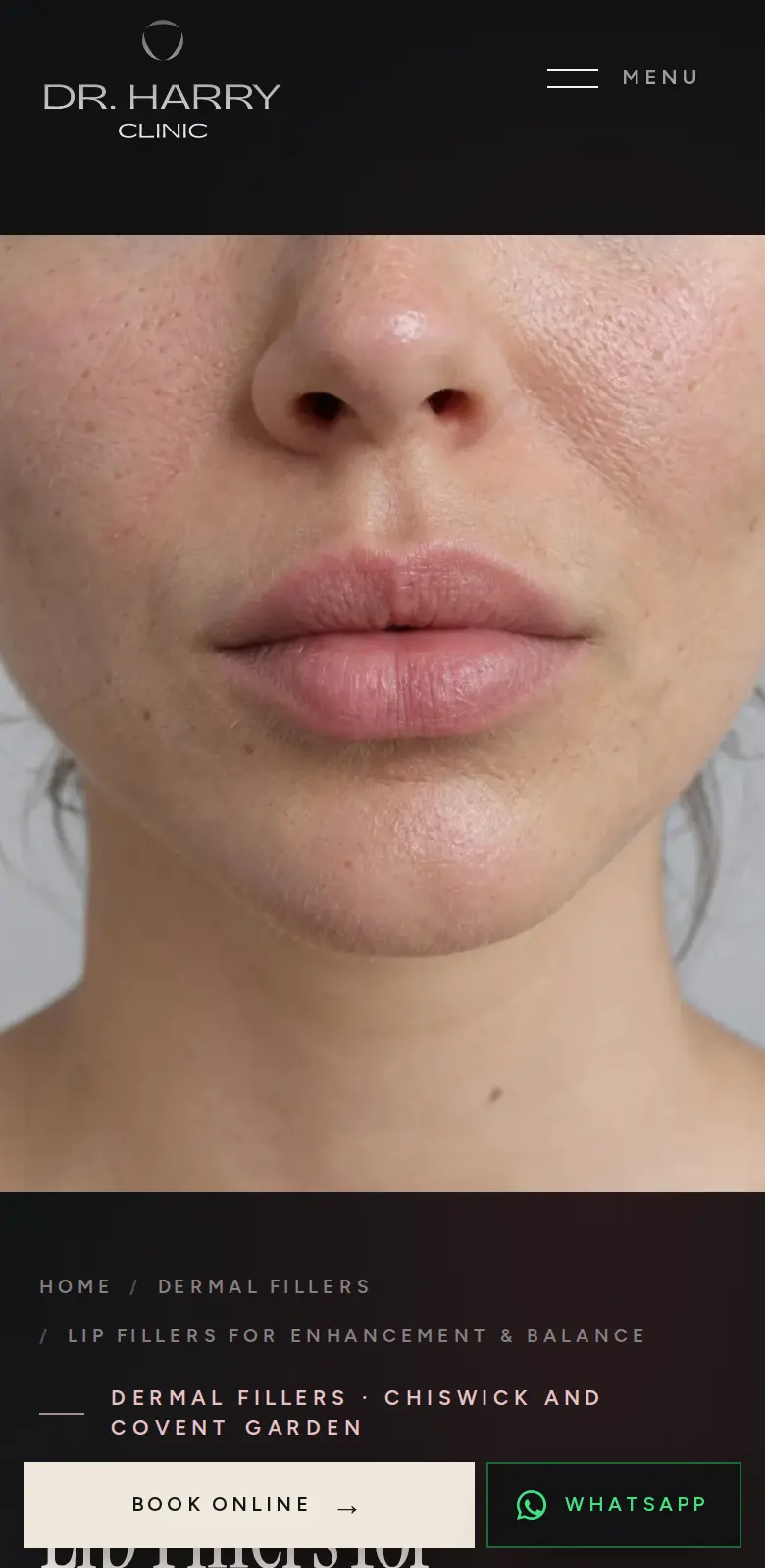 The lip filler page on a phone, with booking and WhatsApp always in reach